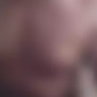 Tap