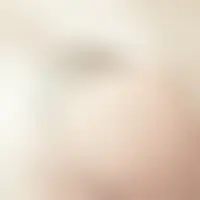 Melvin69